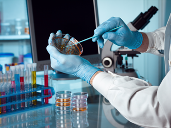 Pregled prostate i laboratorijska hormonska analiza